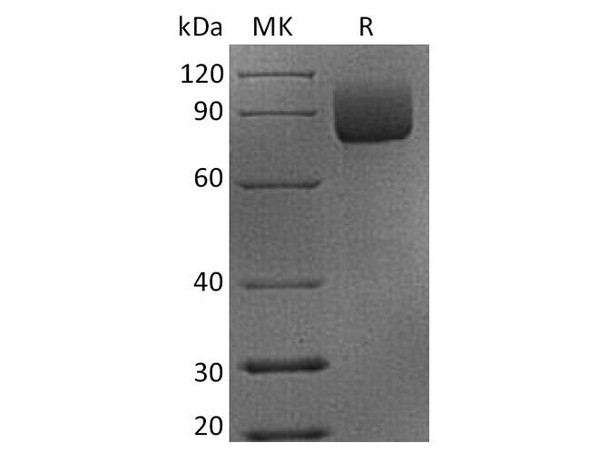Rhesus macaque CD19 Recombinant Protein (RPES3900)