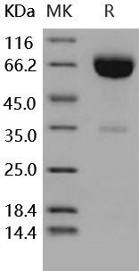 Human IFNAR2/IFNABR Recombinant Protein (Fc Tag) (Active) (RPES3904)