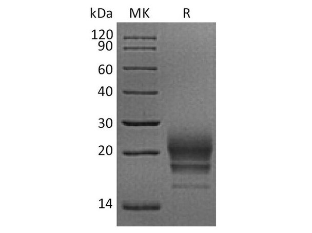 Rhesus macaque CD160 Recombinant Protein (RPES3922)