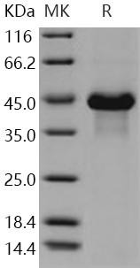 Human VWC2/Brorin Recombinant Protein (His Tag) (RPES3924)