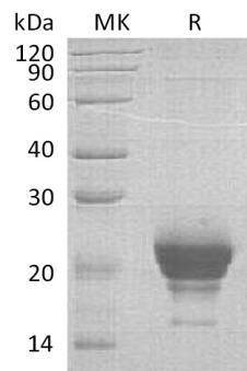 Human Ribonuclease K6/RNASE6 Recombinant Protein (RPES3935)