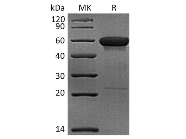 Rhesus macaque CD160 Recombinant Protein (RPES3943)