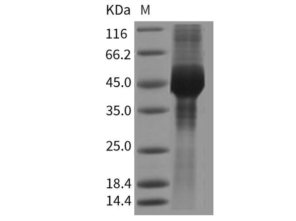 Mouse GFRA3/GFR-alpha-3 Recombinant Protein (His Tag) (RPES3971)
