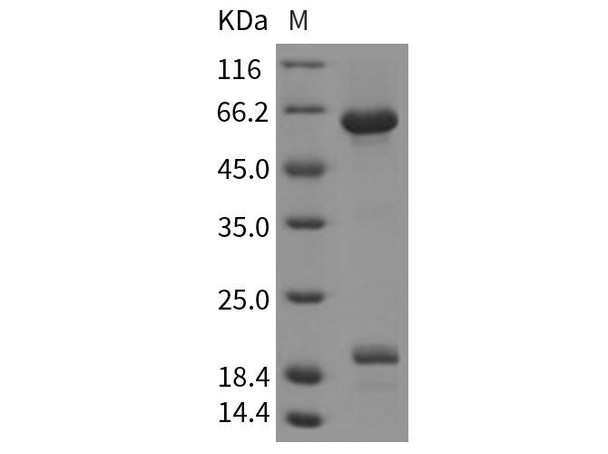 Rat B7-H6/NCR3LG1 Recombinant Protein (RPES3978)