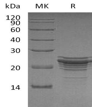 Human FGF21 Recombinant Protein (His Tag) (RPES3997)