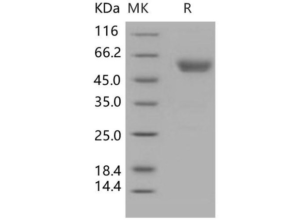 Human Podoplanin/PDPN Recombinant Protein (His & Fc Tag) (Active) (RPES4011)