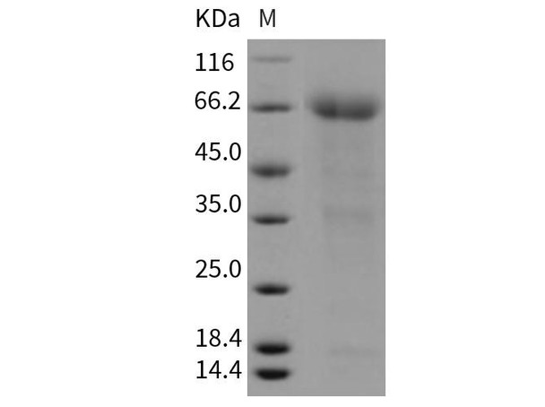 Mouse EPCR Recombinant Protein (Fc Tag) (RPES4035)