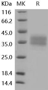 Mouse CD32/FCGR2B Recombinant Protein (RPES4067)