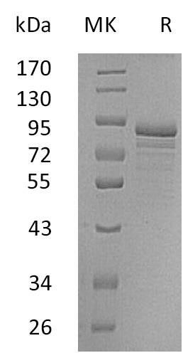Human Secretogranin-2/SCG2 Recombinant Protein (RPES4088)