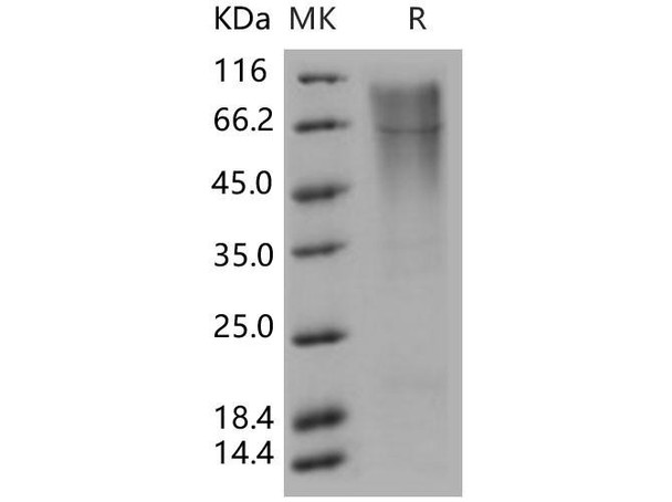 Human TIM1/HACVR1 Recombinant Protein (His Tag) (RPES4103)