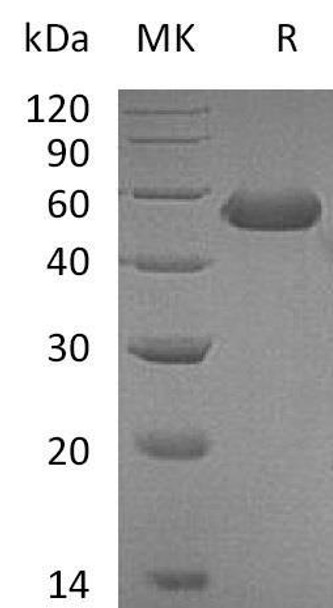 Mouse CD5L Recombinant Protein (His Tag) (RPES4114)