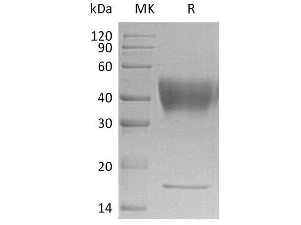 Human IFNGR1 Recombinant Protein (RPES4121)