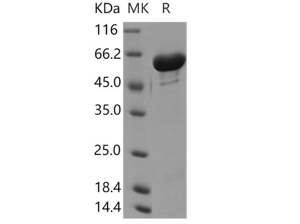 Human GALNT2/GalNAc-T2 Recombinant Protein (His Tag) (RPES4125)