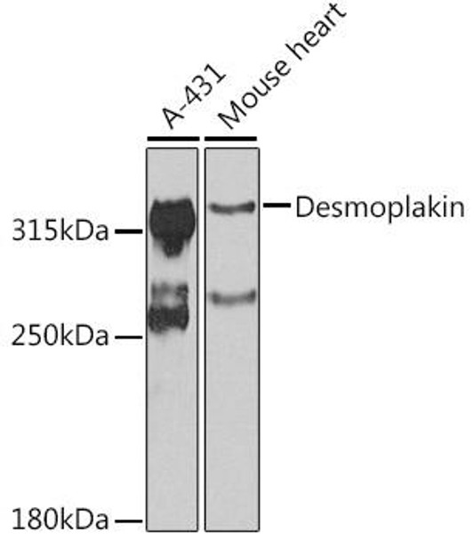 Anti-Desmoplakin Antibody (CAB7635)