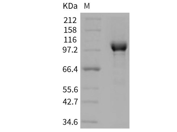 Human PARP Recombinant Protein (RPES4174)