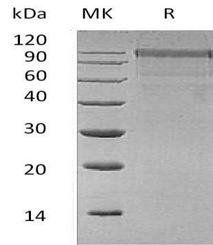 Human MASP1 Recombinant Protein (RPES4231)
