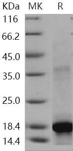 Human c-KIT/CD117 Recombinant Protein (aa 5090, His Tag) (RPES4245)