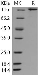 Human UBE1/UBA1 Recombinant Protein (His & GST Tag) (RPES4270)