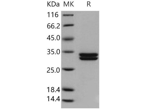 Human Kallikrein 7/KLK7 Recombinant Protein (RPES4277)