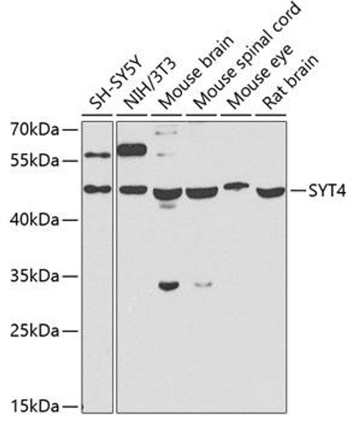 Anti-SYT4 Antibody (CAB7737)