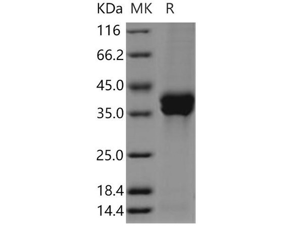 Human STC2/Stanniocalcin 2 Recombinant Protein (His Tag) (RPES4367)