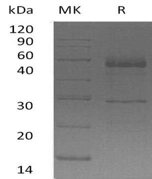 Human Semenogelin/SEMG1 Recombinant Protein (RPES4378)
