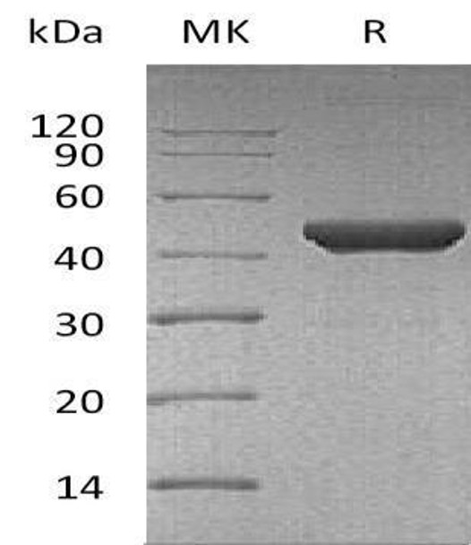 Human Fumarase/FH Recombinant Protein (RPES4400)