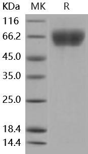 Mouse FGFR3 Recombinant Protein (His Tag) (Active) (RPES4469)
