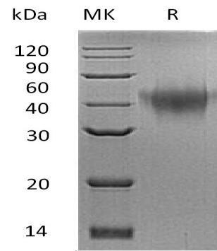 Mouse TNFRSF1B/CD120b Recombinant Protein (His Tag) (Active) (RPES4484)