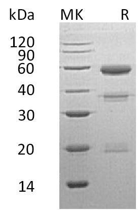Human Carboxypeptidase E/CPE Recombinant Protein (RPES4486)