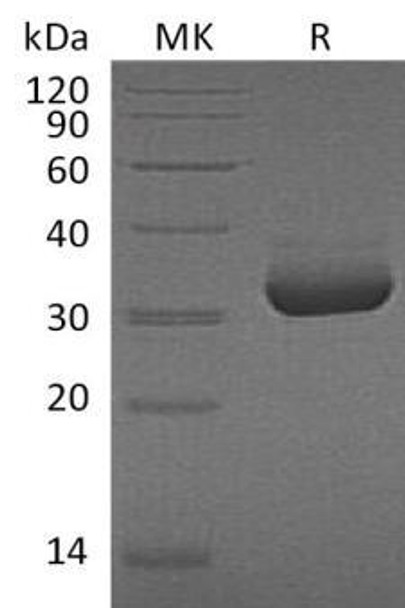 Human Mesothelin/MSLN Recombinant Protein (RPES4488)