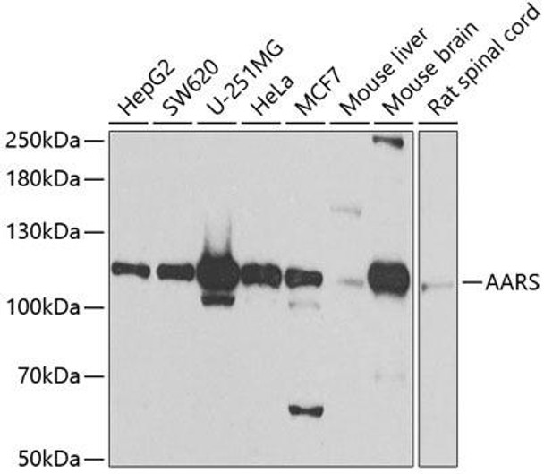 Anti-AARS Antibody (CAB7864)