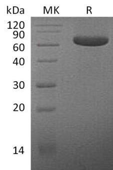 Human Mesothelin/MSLN Recombinant Protein (RPES4510)