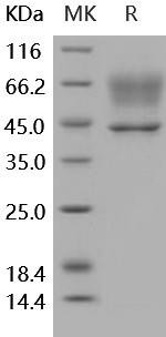 Human SerpinA3/AACT Recombinant Protein (RPES4546)