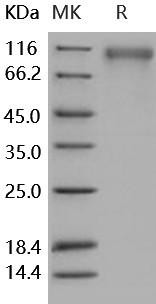 Human SLITRK1 Recombinant Protein (His Tag) (RPES4551)