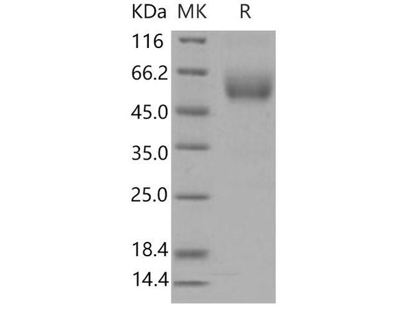 Mouse SIGIRR/TIR8 Recombinant Protein (RPES4568)