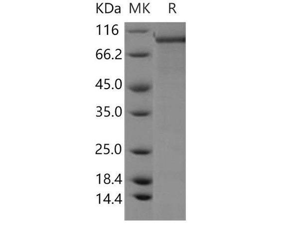 Human PDE1C Recombinant Protein (RPES4584)