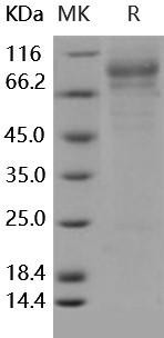 Human Iduronate 2-Sulfatase/IDS Recombinant Protein (His Tag) (Active) (RPES4611)