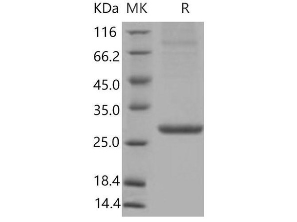 Mouse APCS/SAP Recombinant Protein (His Tag) (Active) (RPES4631)
