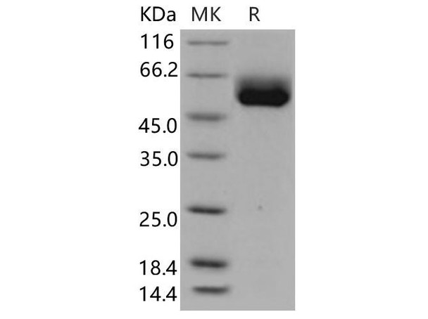 Human IL1RL1/ST2 Recombinant Protein (isoform a, His Tag) (Active) (RPES4651)