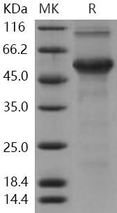 Human DMP1 Recombinant Protein (His Tag) (Active) (RPES4687)