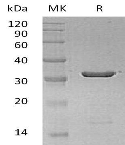 Human Galectin-8/LGALS8 Recombinant Protein (Active) (RPES4696)