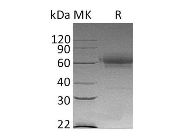 Mouse CD27/TNFRSF7 Recombinant Protein (RPES4700)