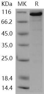 Human CASK Kinase Recombinant Protein (RPES4752)