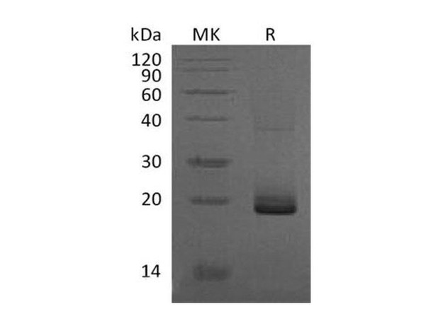 Mouse ESM1/Endocan Recombinant Protein (RPES4770)