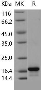 Pleiotrophin/PTN/HB-GAM Recombinant Protein  (RPES4776)