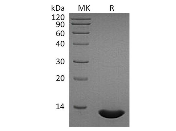 Human CCL2/MCP Recombinant Protein (RPES4803)