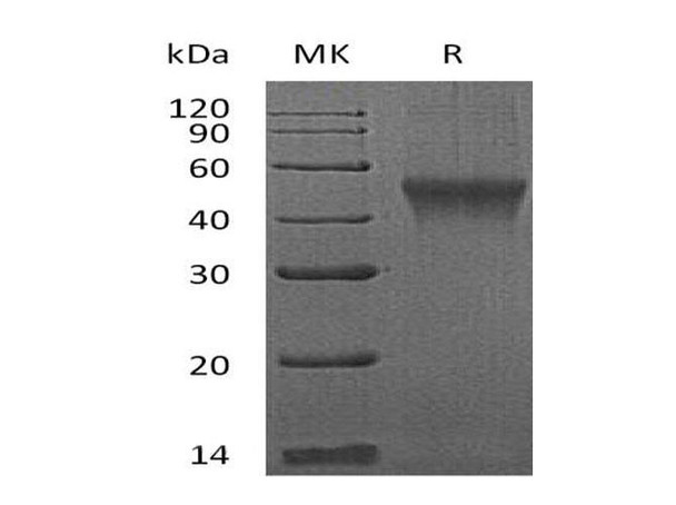 Mouse FCRL1 Recombinant Protein (RPES4832)