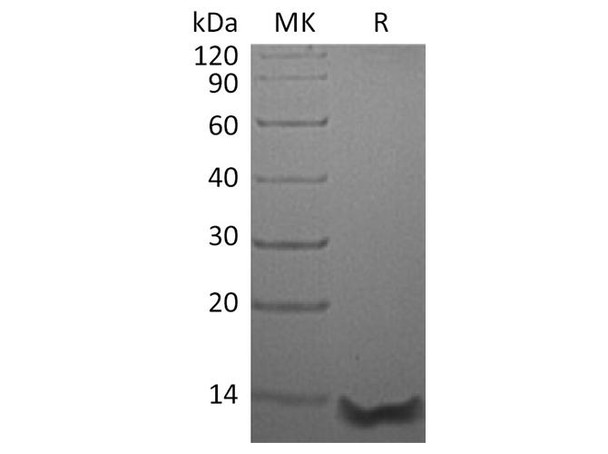 Human Eotaxin-3/CCL26 Recombinant Protein (RPES4843)