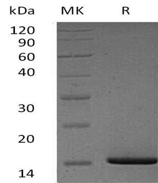 Human Serum Amyloid A1/SAA1 Recombinant Protein (RPES4867)